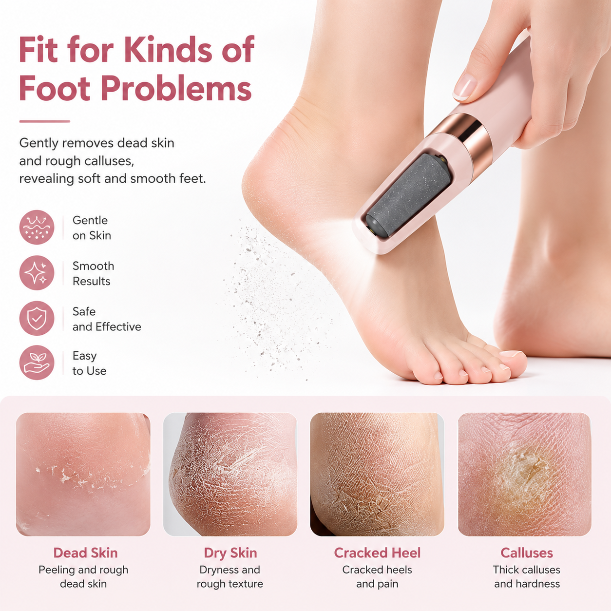 Rechargeable Electric Foot Callus Remover