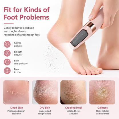 Rechargeable Electric Foot Callus Remover
