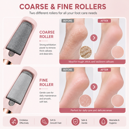 Rechargeable Electric Foot Callus Remover